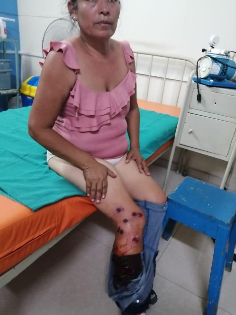 Policía arremete violentamente contra madres de familia en Cayalti