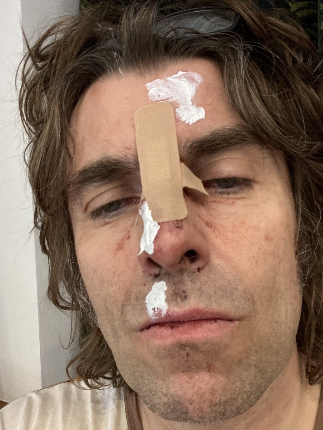 Ex cantante de Oasis se cayó de un helicóptero