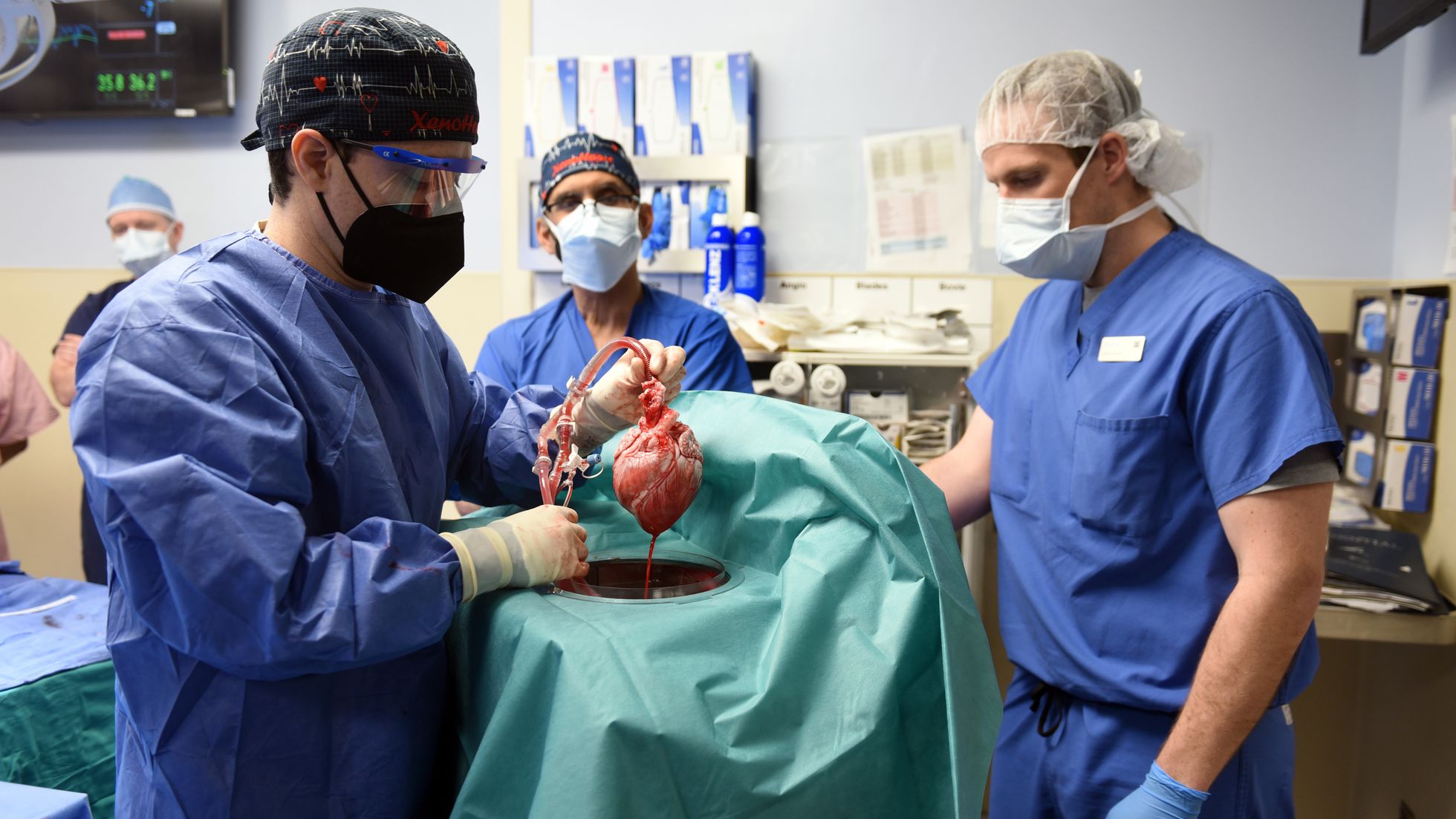 Corazón de cerdo usado en trasplante estaba infectado con virus porcino