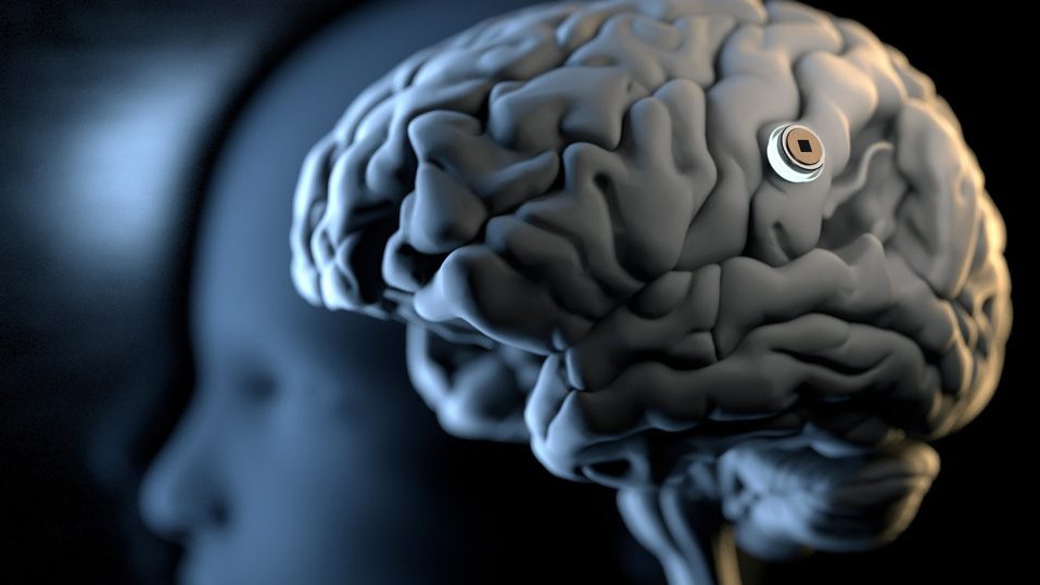 EE.UU da luz verde a experimento de implantar chips en cerebro humano