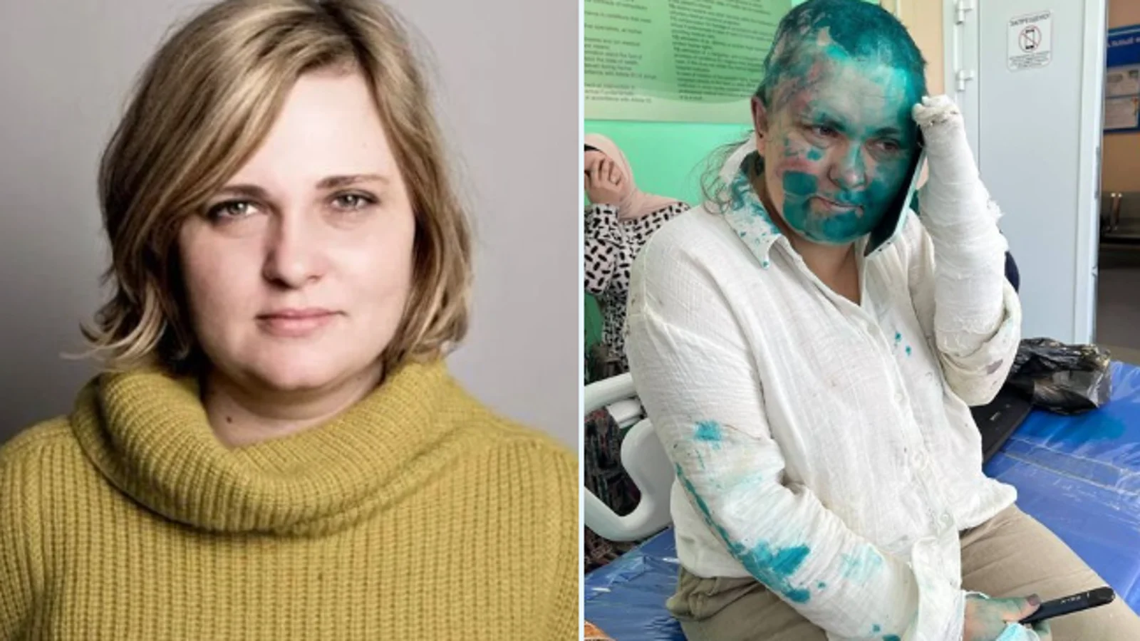 Periodista rusa sufre agresión mientras documentaba agresiones en la federación rusa de Chechenia