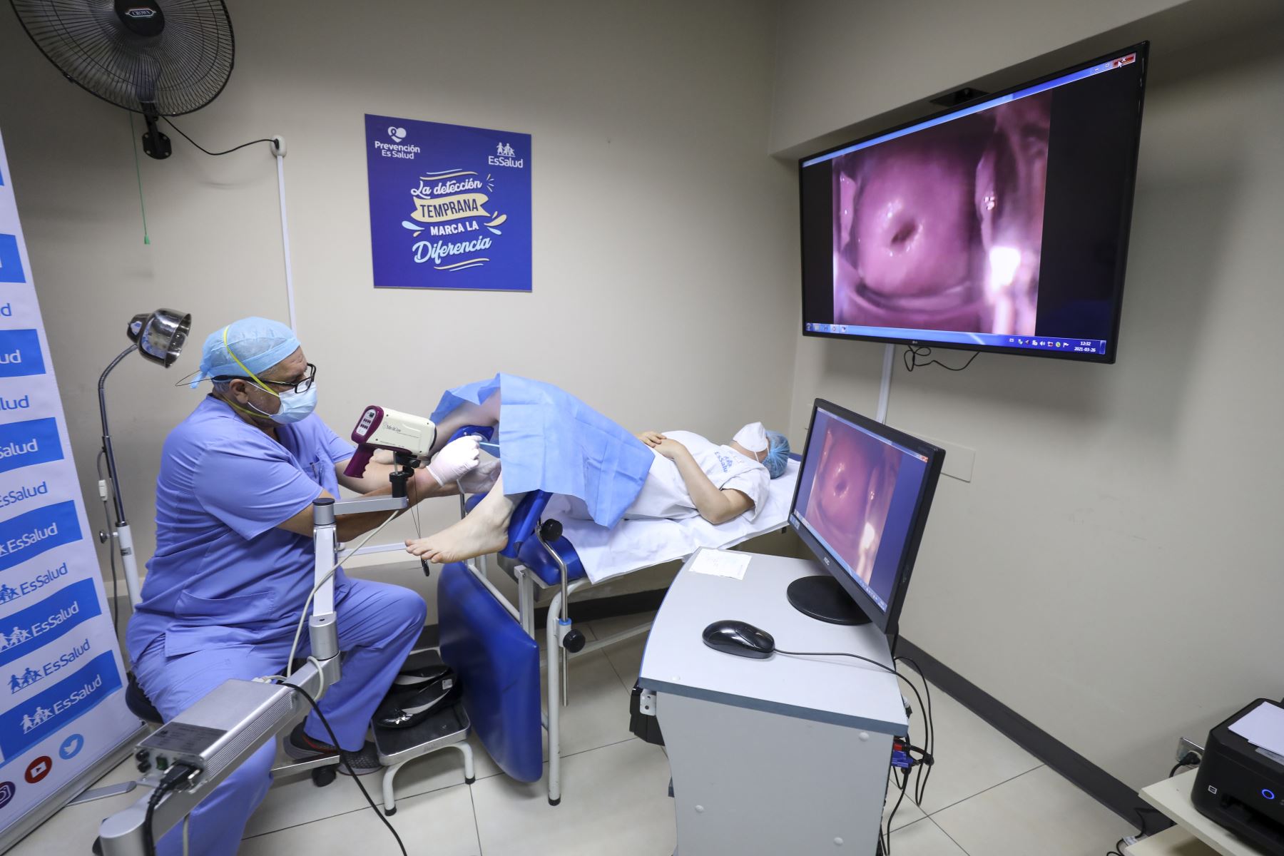 EsSalud realizó más de 446 mil exámenes preventivos de cáncer ginecológico