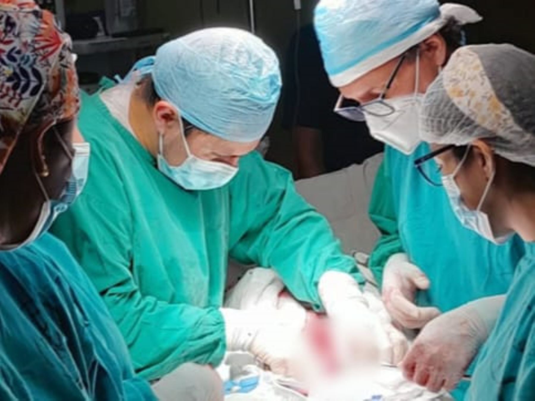 Hospital Loayza: extraen tumor de 17 centímetros en abdomen de una menor