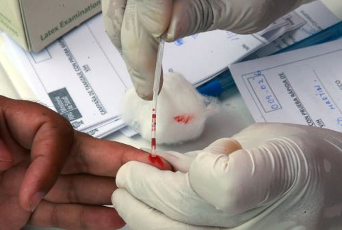 La mayor parte de los casos de VIH en Perú afecta a individuos de 20 a 24 años de edad