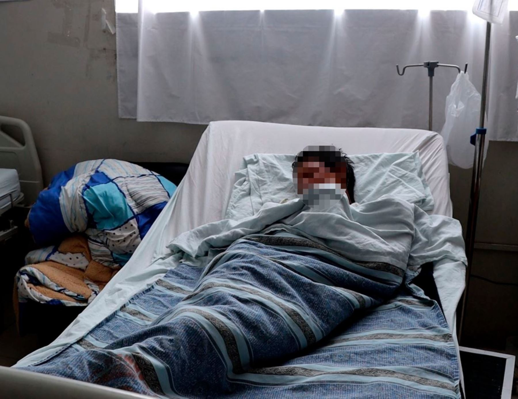 Huancayo: menor grave por quemaduras en el rostro causada por pirotécnico