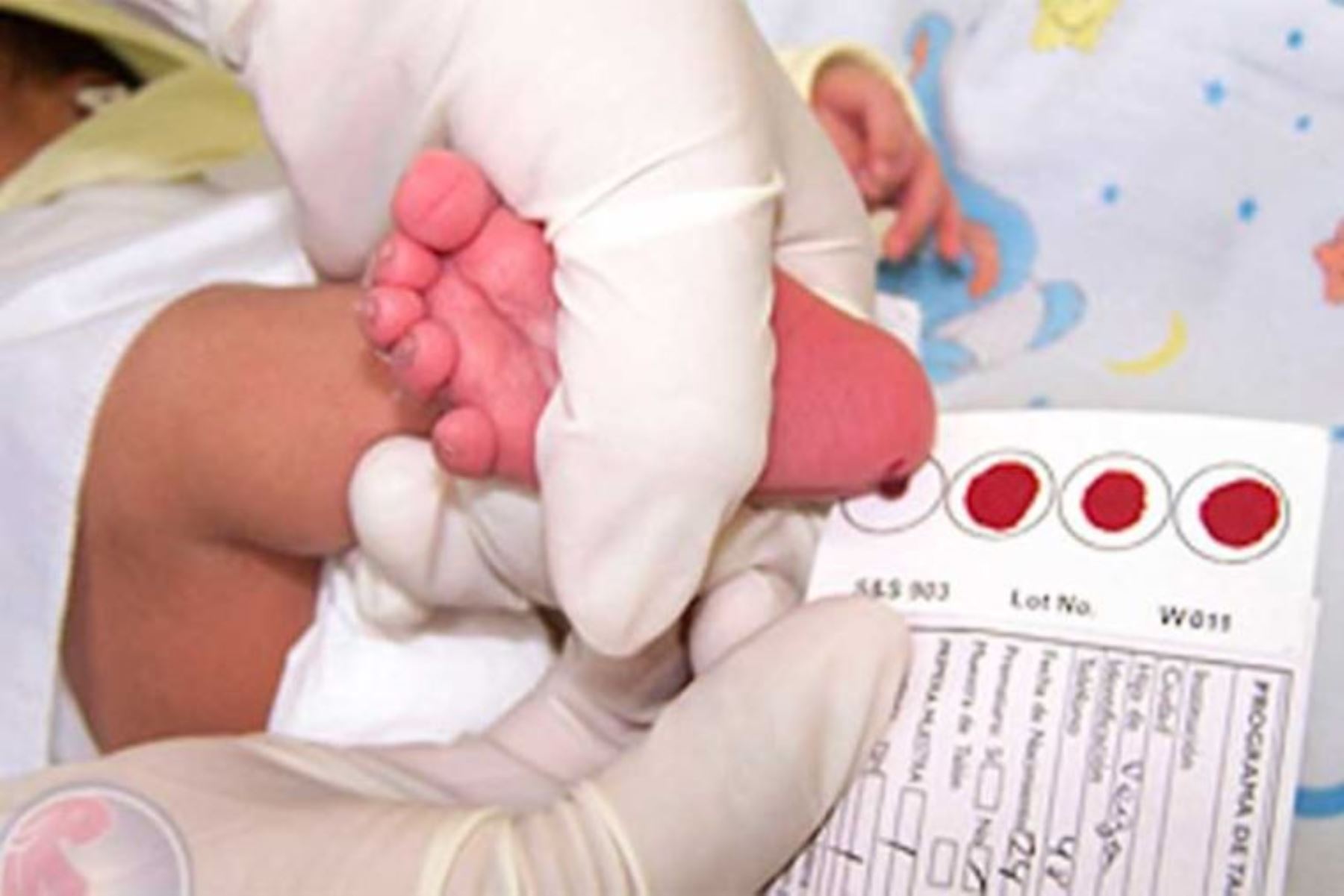 ¡Un hito! Nuevo tamizaje neonatal universal impactará en la salud pública