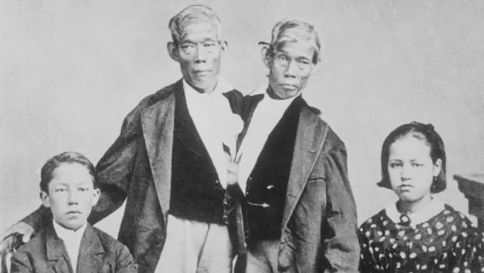 Chang y Eng Bunker: La historia de los Siameses de América