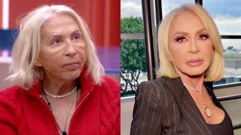 Laura Bozzo muestra su nuevo rostro tras someterse a tratamiento