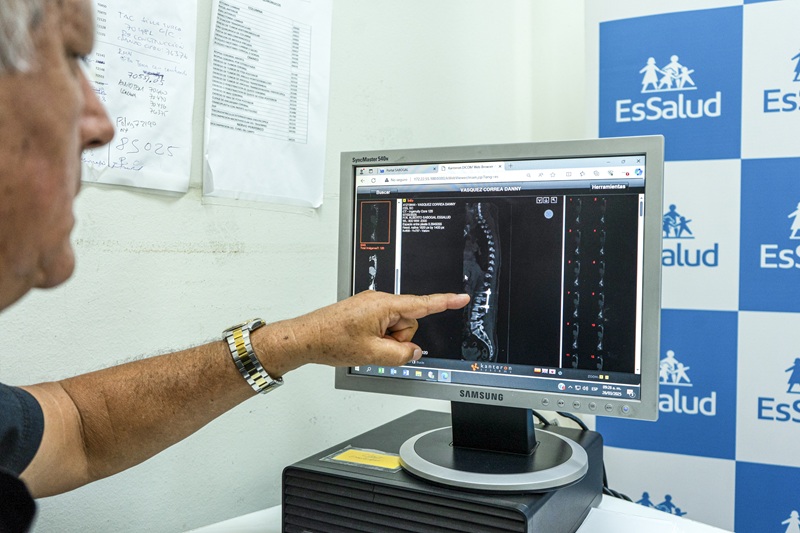 Padre de familia volverá a caminar tras cirugía de columna mínimamente invasiva en hospital Sabogal de EsSalud