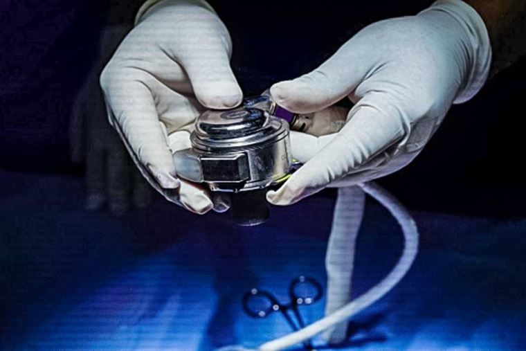 INCOR implanta el primer corazón artificial portátil
