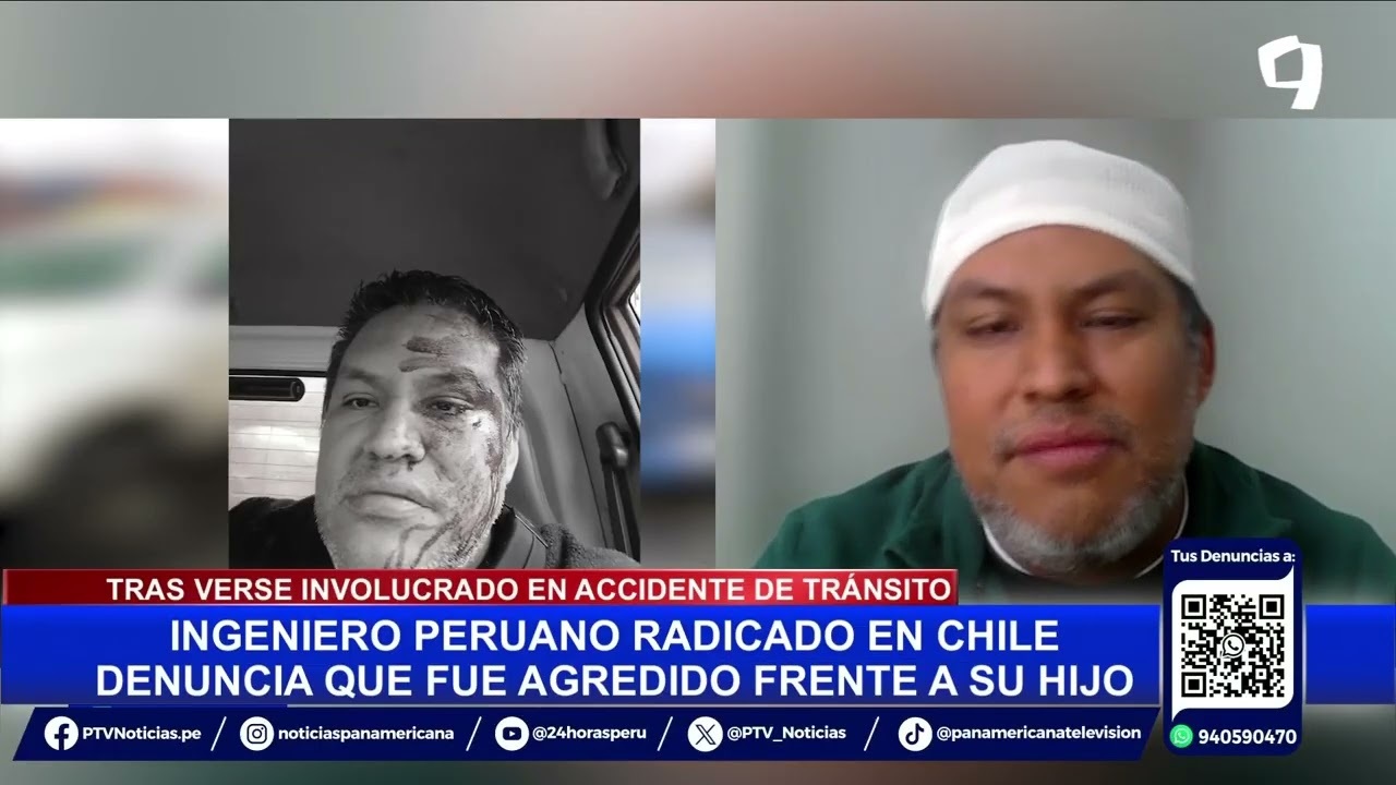 Xenofóbia: Peruano denuncia haber sido golpeado salvajemente por ciudadanos Chilenos