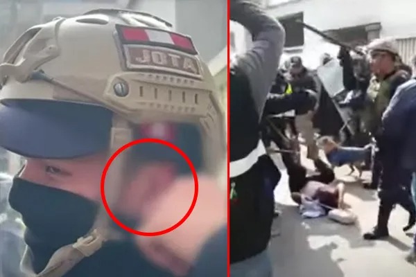 Chosica: Muerde a sereno y le arranca parte de oreja