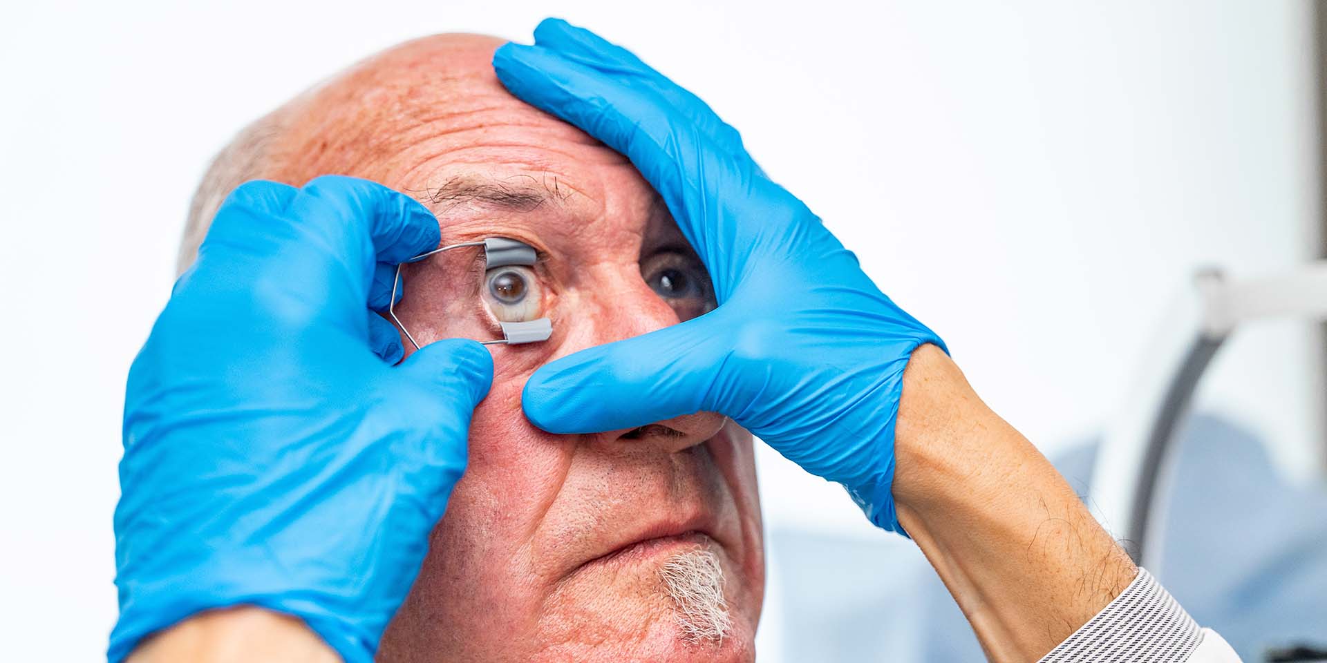 Guía completa sobre la cirugía de catarata: todo lo que debes saber