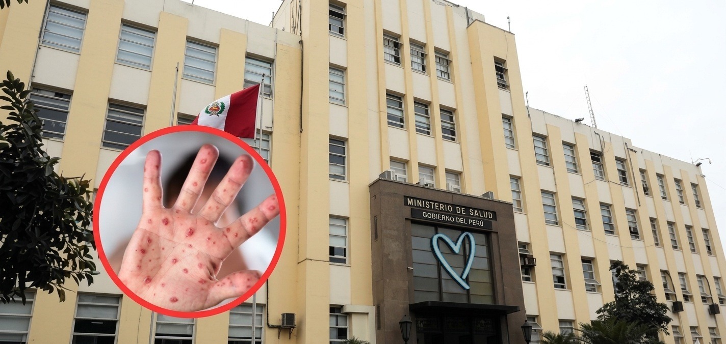 MINSA debe priorizar campañas informativas de prevención ante brote de Sarampión en el país