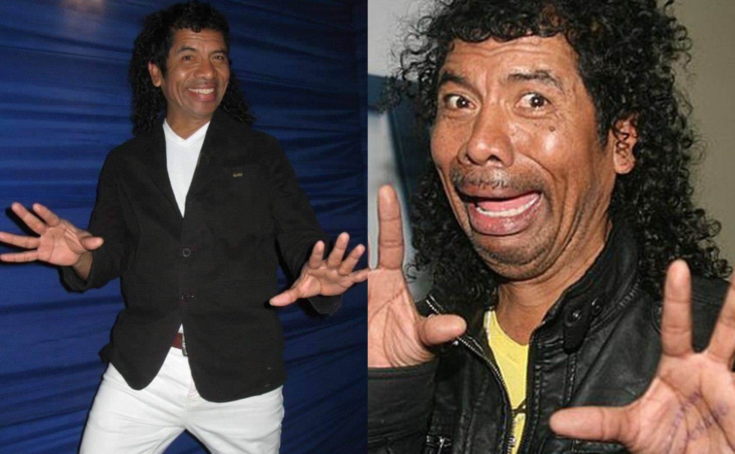 Cachay es empujado en pleno show y sufre fractura