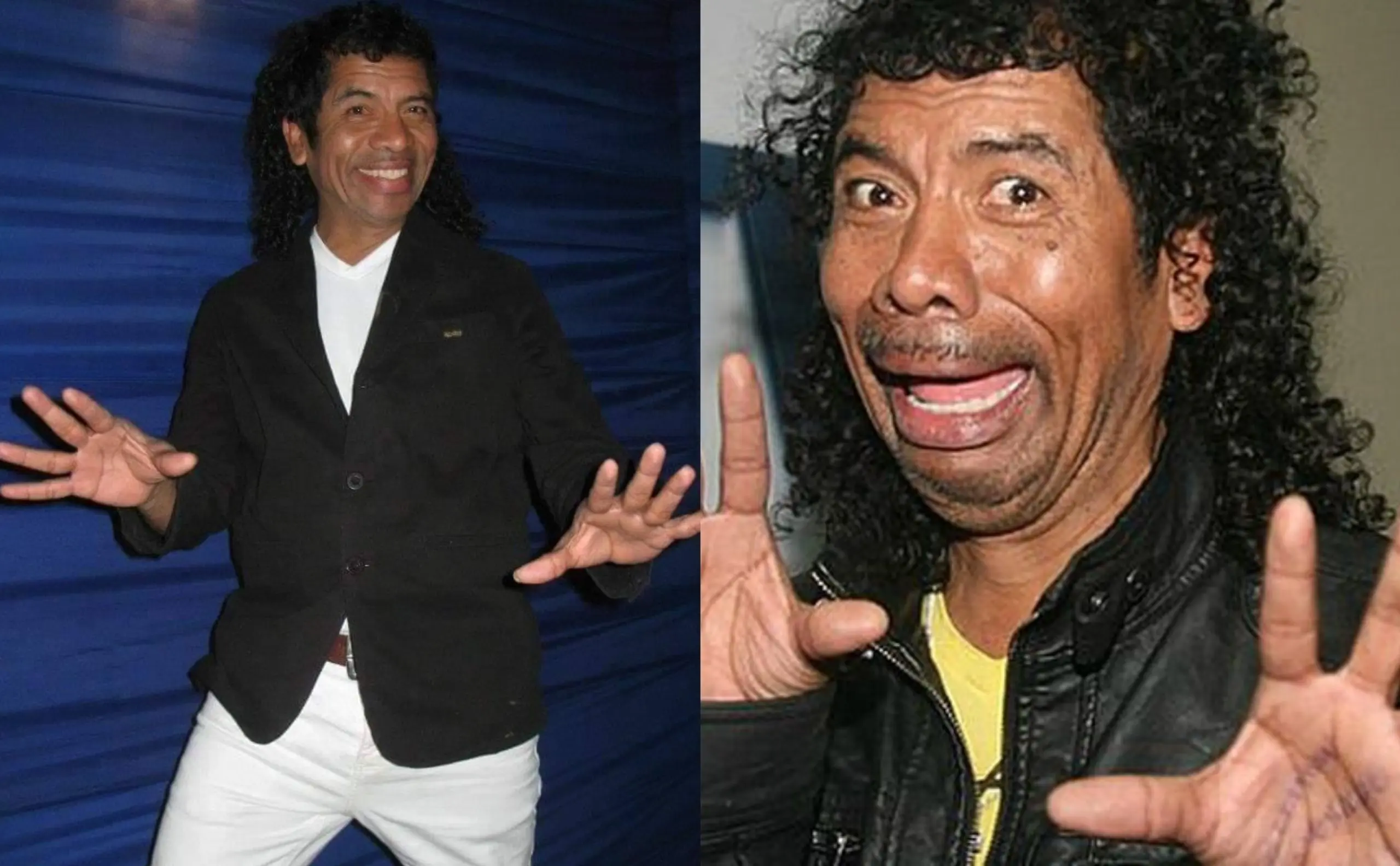 Cachay es empujado en pleno show y sufre fractura